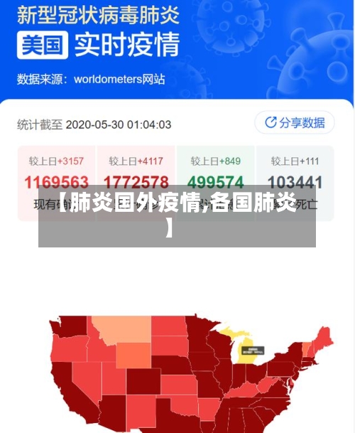【肺炎国外疫情,各国肺炎】-第3张图片