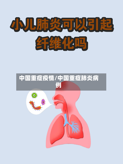 中国重症疫情/中国重症肺炎病例