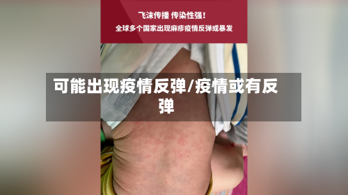 可能出现疫情反弹/疫情或有反弹