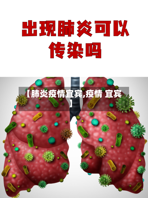 【肺炎疫情宜宾,疫情 宜宾】