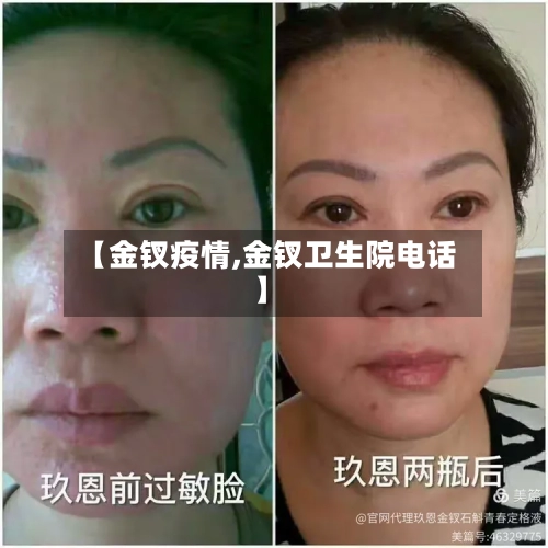 【金钗疫情,金钗卫生院电话】