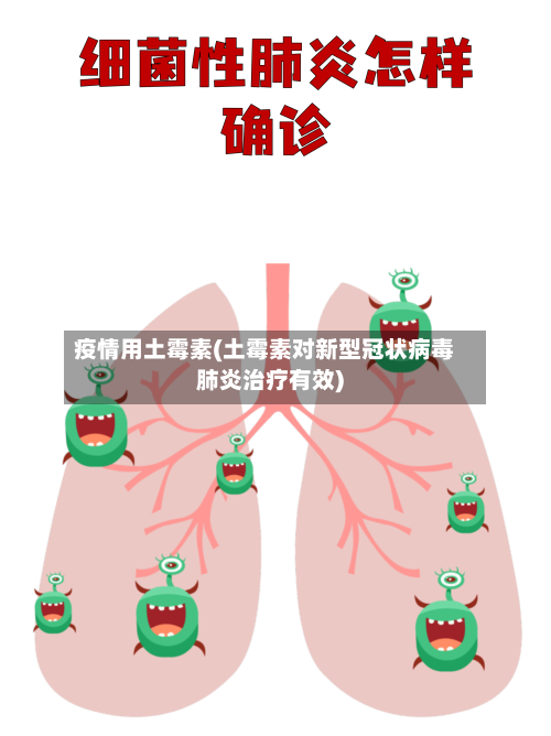 疫情用土霉素(土霉素对新型冠状病毒肺炎治疗有效)-第2张图片