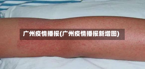 广州疫情播报(广州疫情播报新增图)-第2张图片