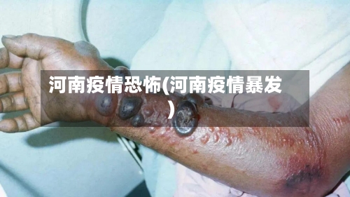河南疫情恐怖(河南疫情暴发)
