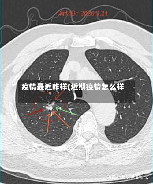 疫情最近咋样(近期疫情怎么样)-第2张图片
