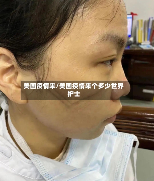 美国疫情来/美国疫情来个多少世界护士-第3张图片