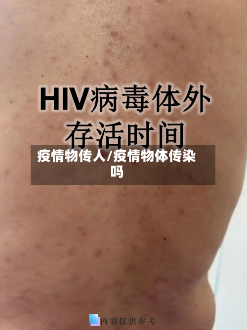 疫情物传人/疫情物体传染吗